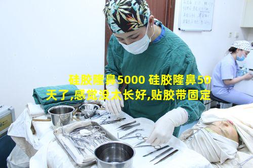 硅胶隆鼻5000 硅胶隆鼻50天了,感觉没太长好,贴胶带固定可以吗
